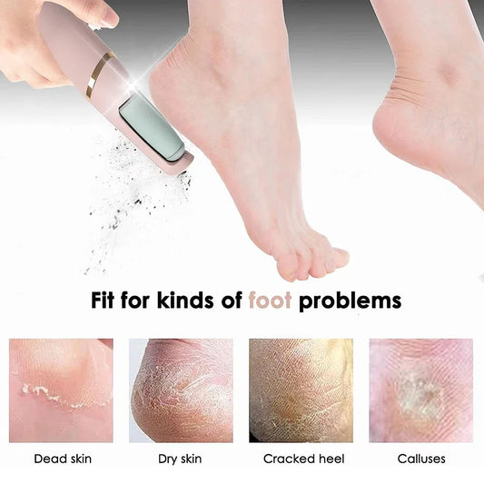 Probezon™️ Foot Callus Shaver